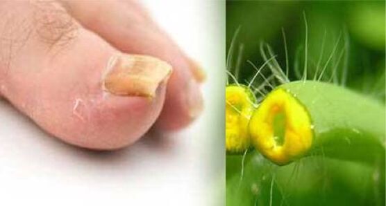 Hierba celidonia para hongos en las uñas de los pies.