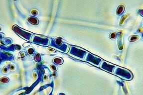 patógeno de hongos en las uñas bajo un microscopio