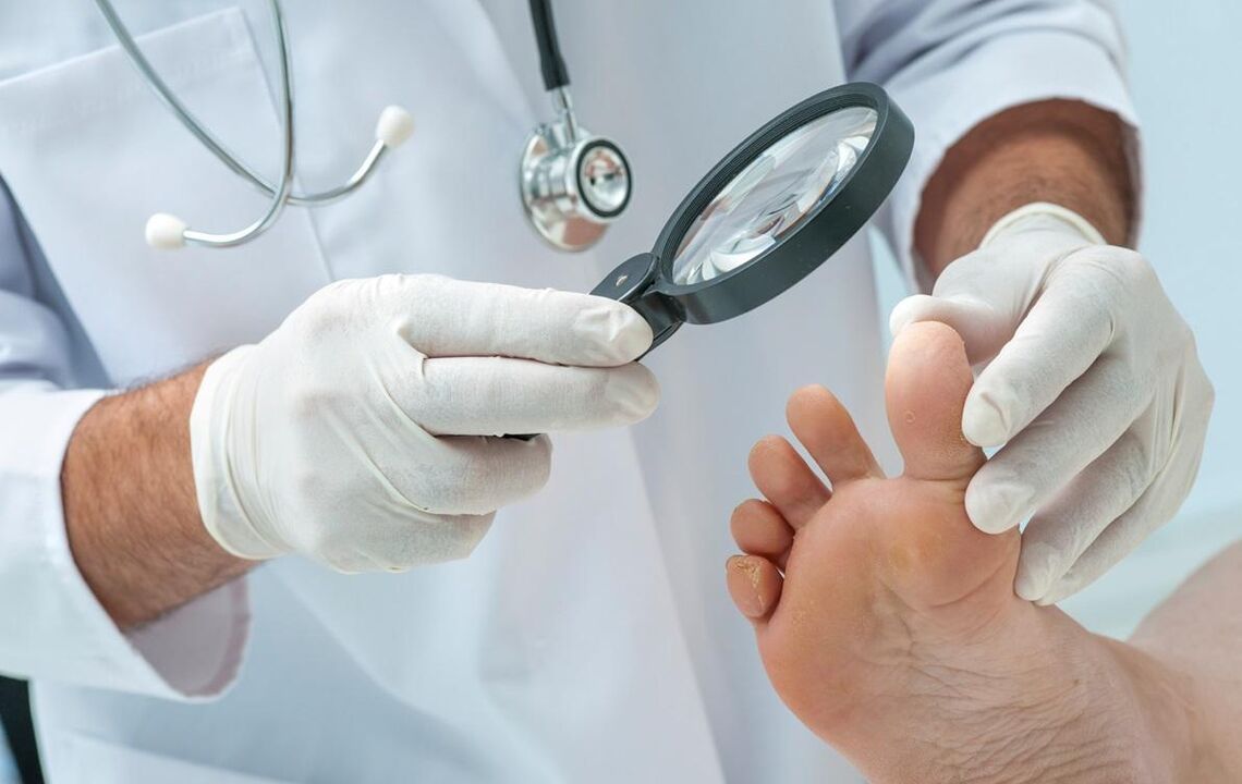 El médico examina las uñas en busca de hongos.